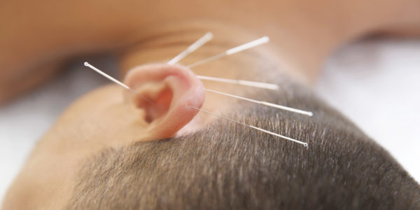 What Conditions Can Be Treated With Acupuncture? - Daily Nutrition News