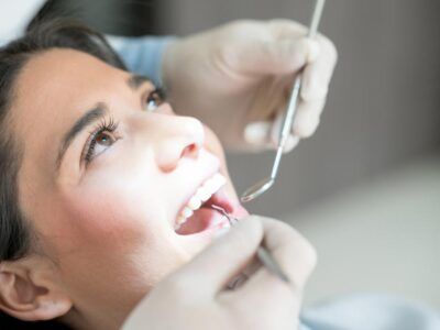 composite fillings