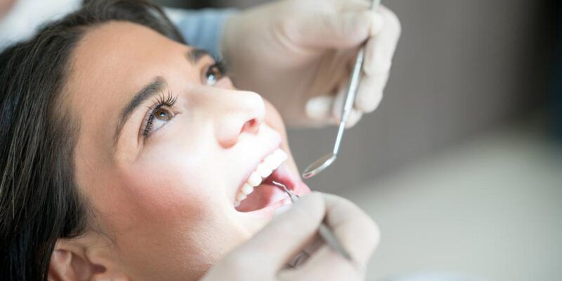 composite fillings